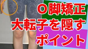 Read more about the article Ｏ脚矯正　大転子を隠すポイント